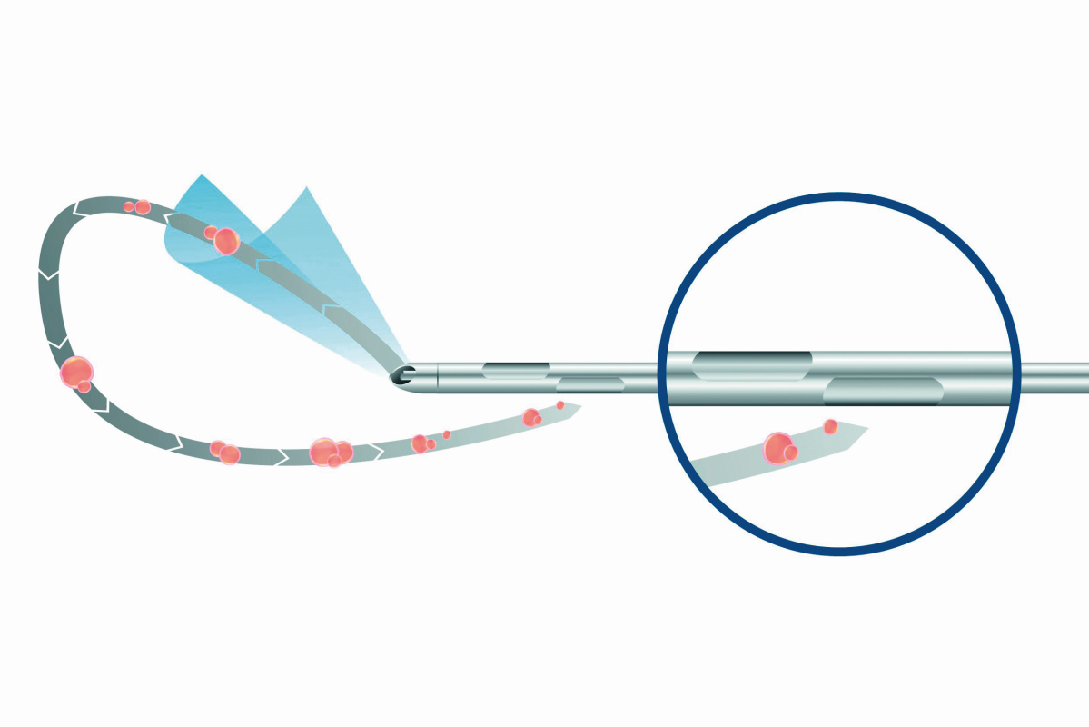 jak funguje kanyla při water-jet liposukci