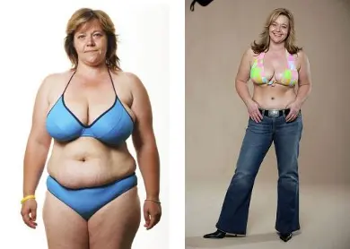 modelace a zmenšení prsou před a po