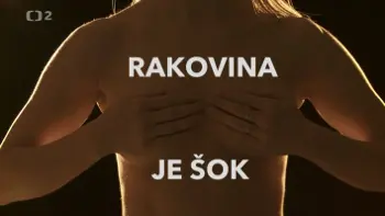 rakovinaJeSok-ct2102015-maly