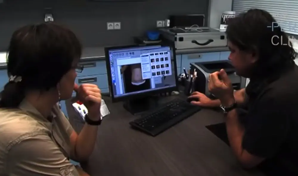 абдоминопластика После 6 недель