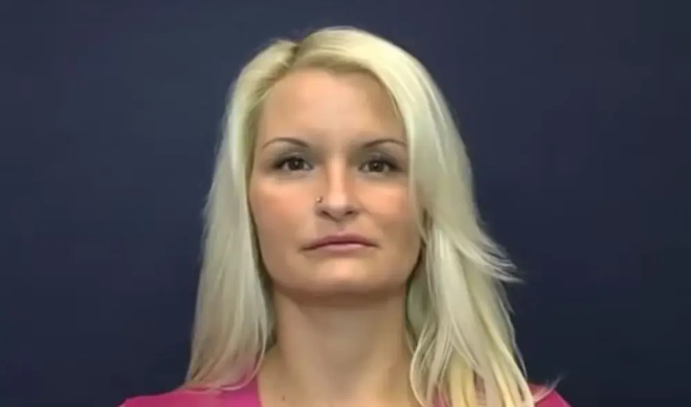 Увеличение губ (Липолифтинг)