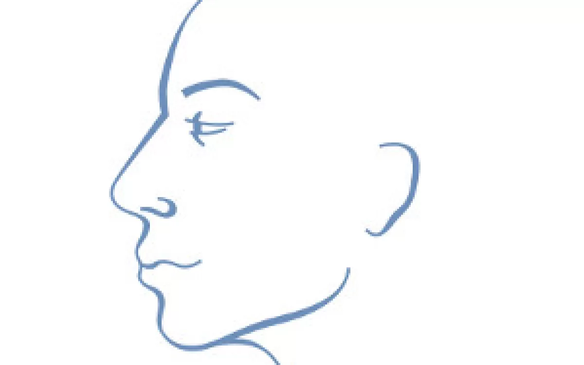 Na chr&aacute;p&aacute;n&iacute; laserem!