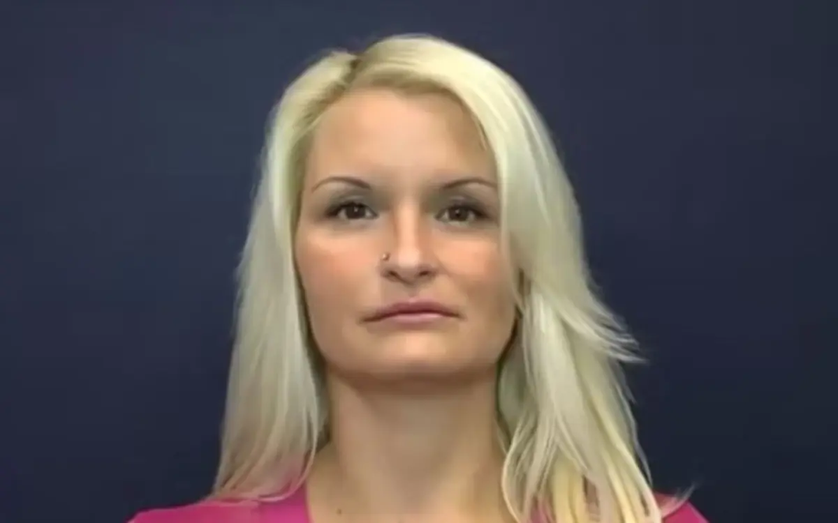 Увеличение губ (Липолифтинг)