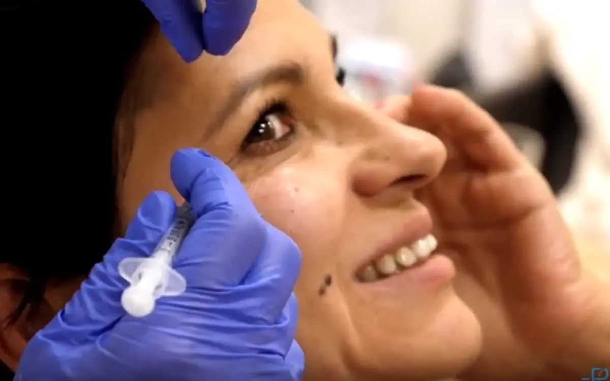 Anti-aging przemiany - Skinbooster, korekcja brwi