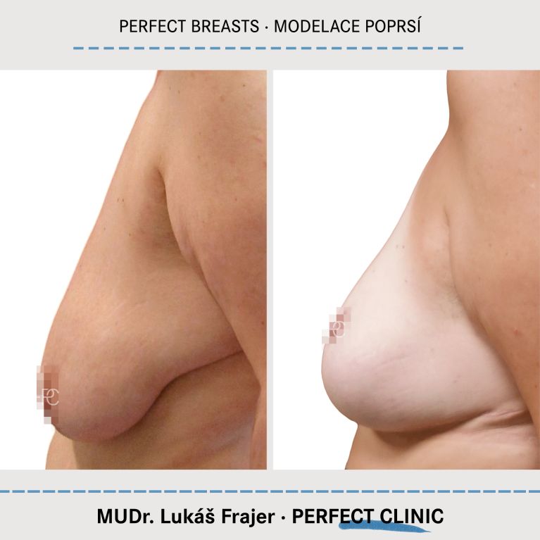 Modelace prsou