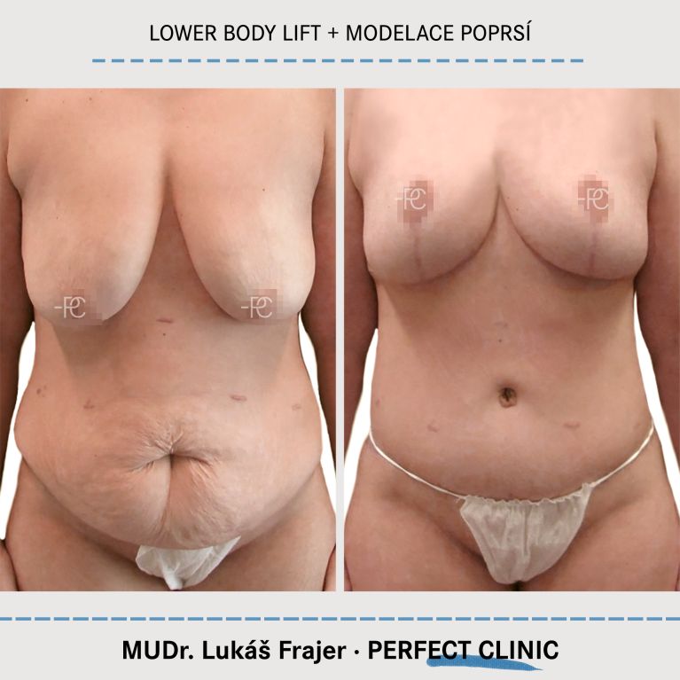 Body Sculpturing