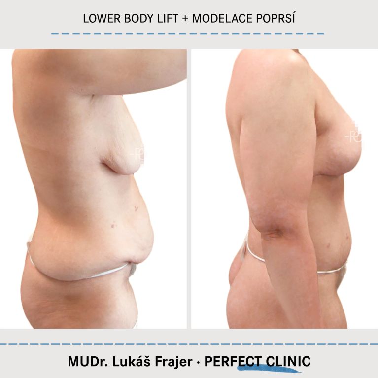 Body Sculpturing