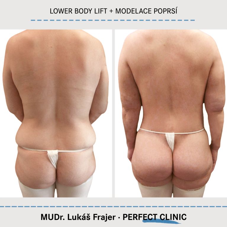 Body Sculpting