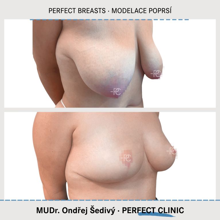 Modelace prsou