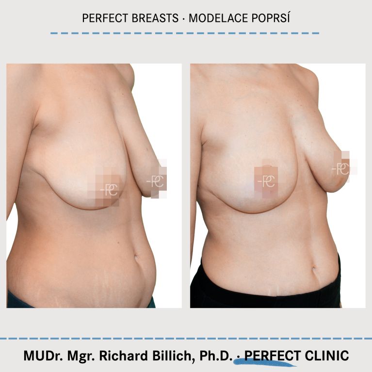 Modelace prsou