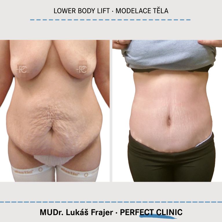 Body Sculpturing
