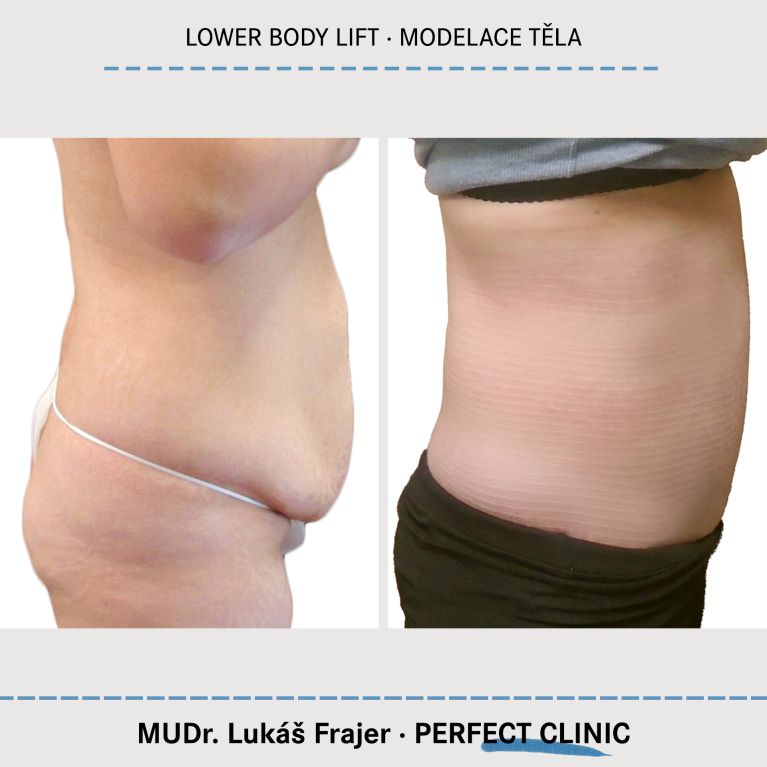 Body Sculpturing