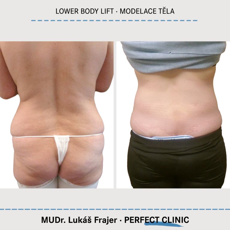 Body Sculpturing