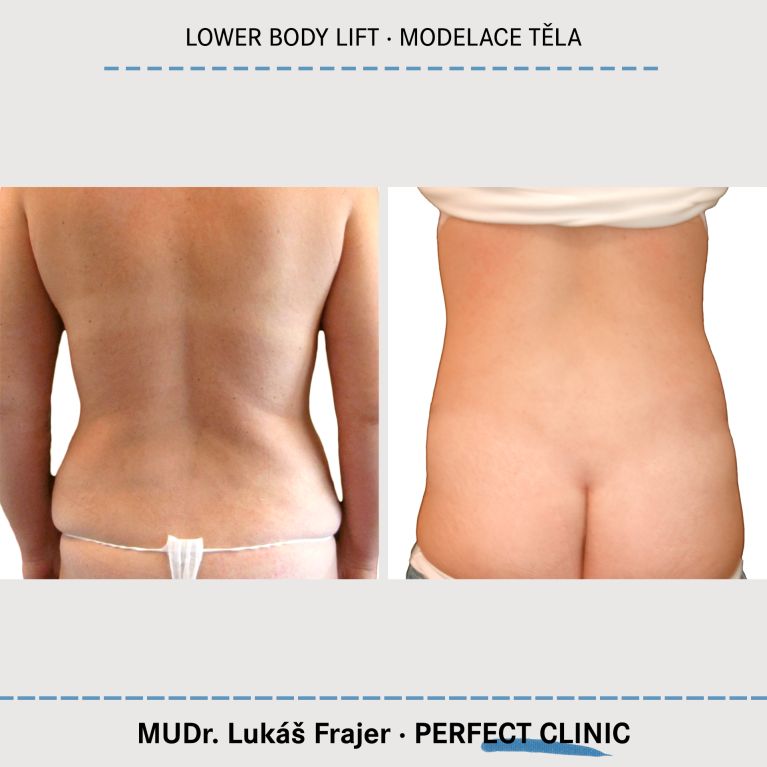 Body Sculpturing