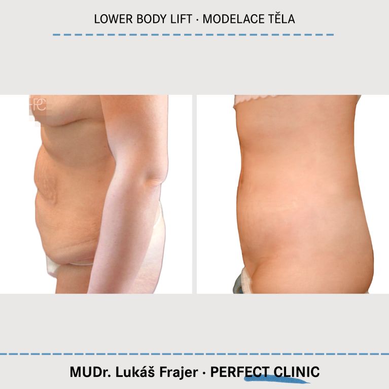 Body Sculpturing