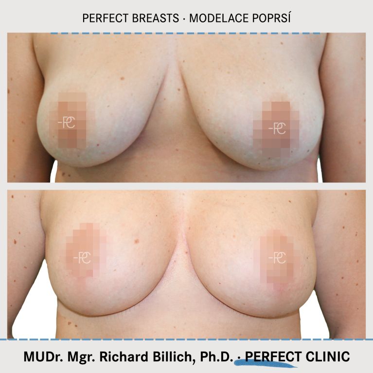 Modelace prsou