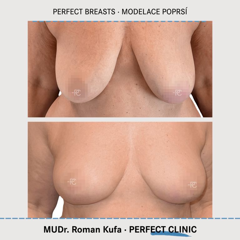 Modelace prsou