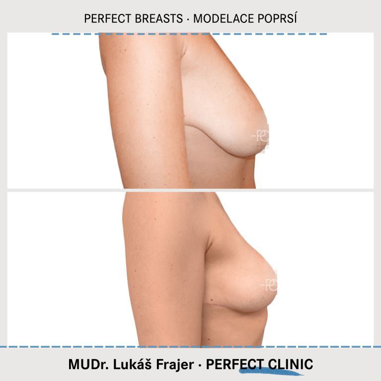 Modelace prsou