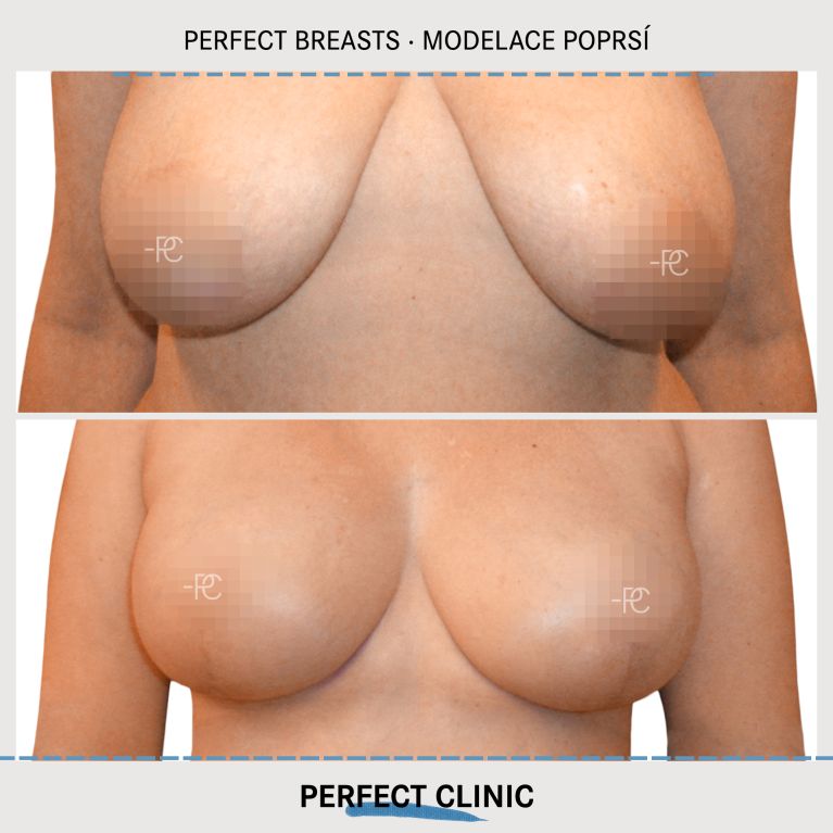 Modelace prsou