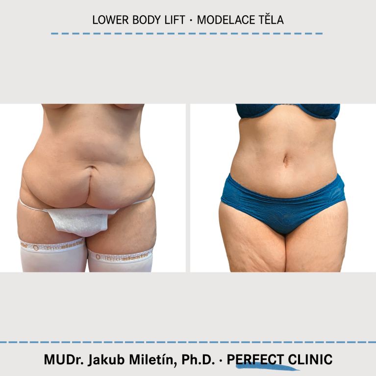 Body Sculpturing