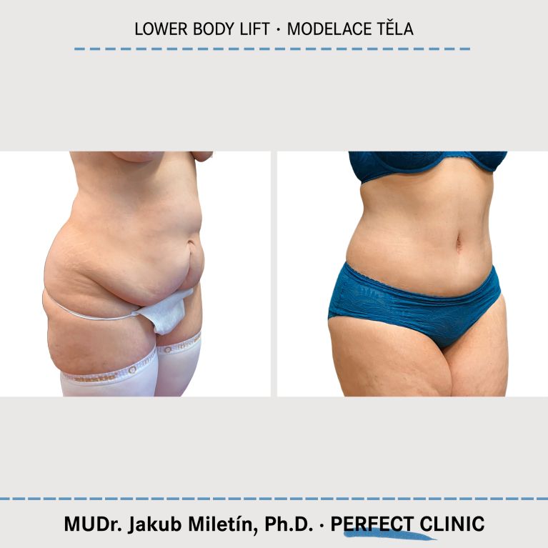 Body Sculpturing