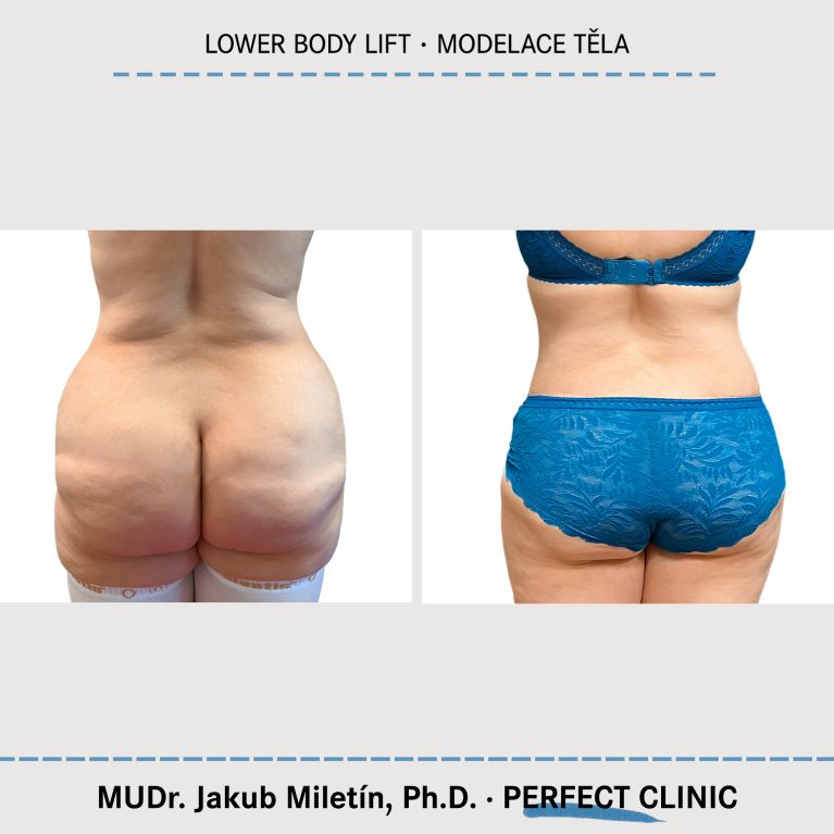 Body Sculpturing