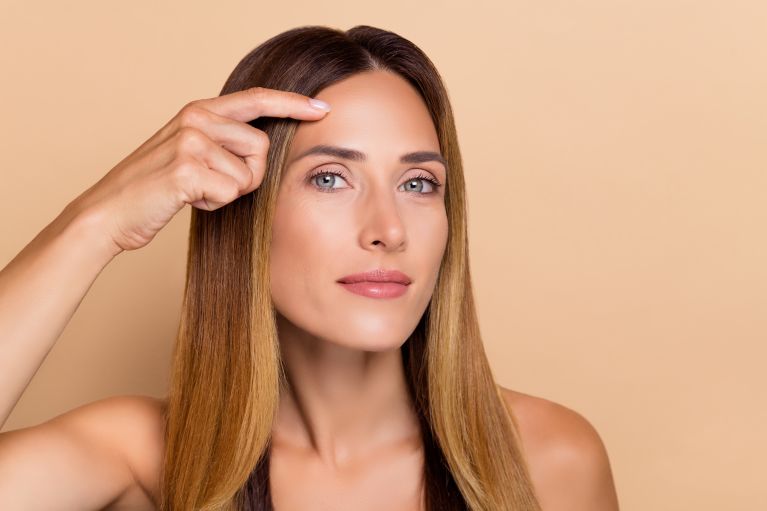 Browlift