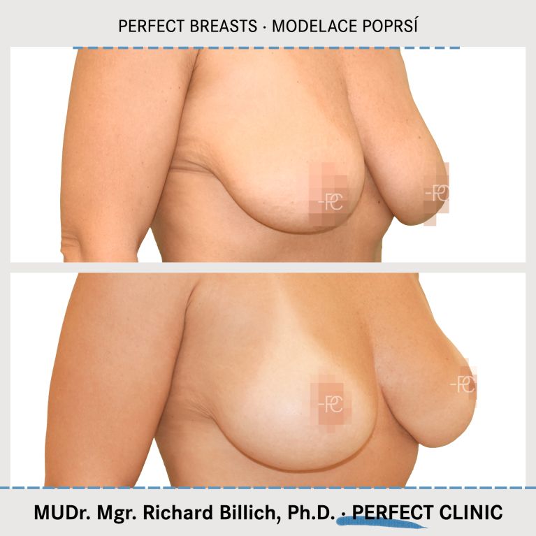 Modelace poprsí