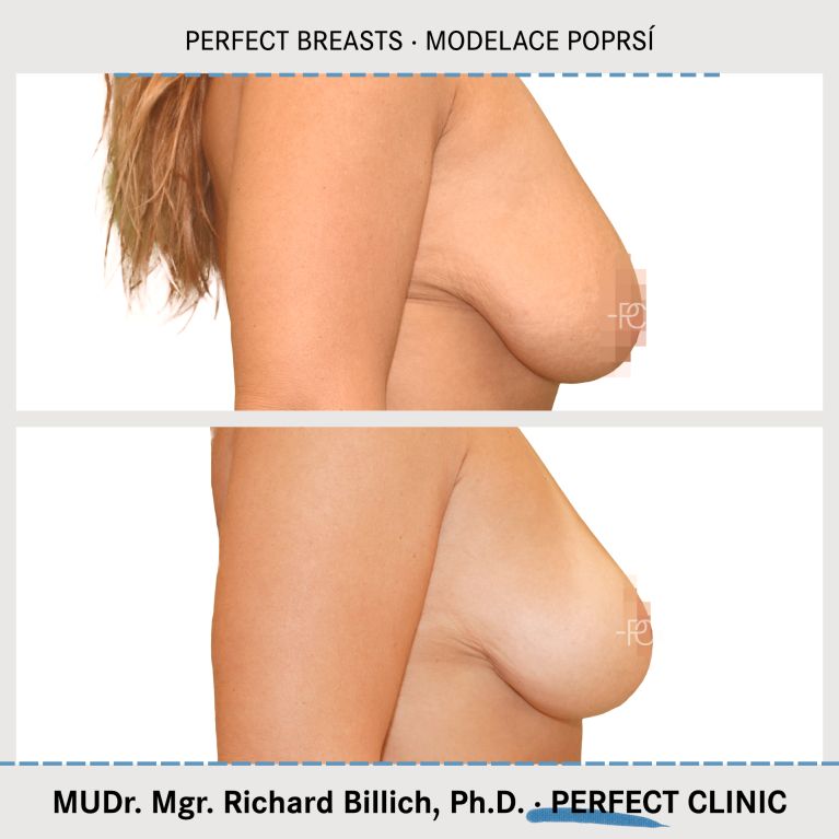 Modelace poprsí