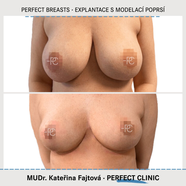 Modelace poprsí