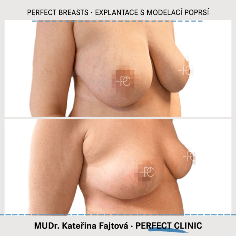 Modelace poprsí