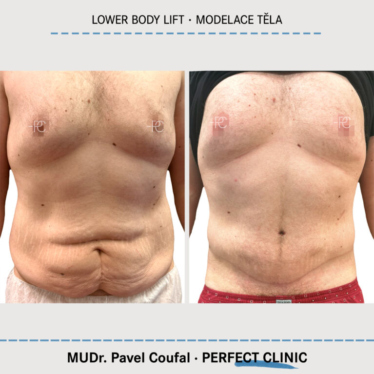 Body Sculpturing