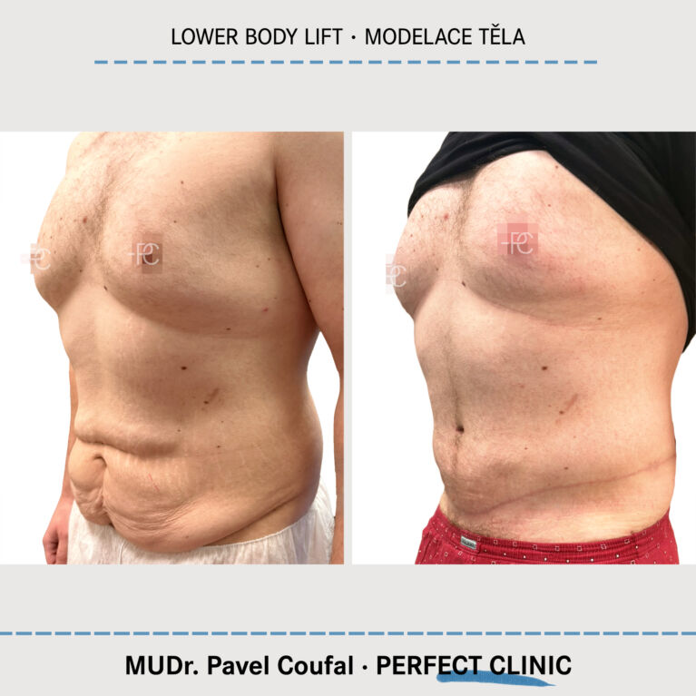 Body Sculpturing