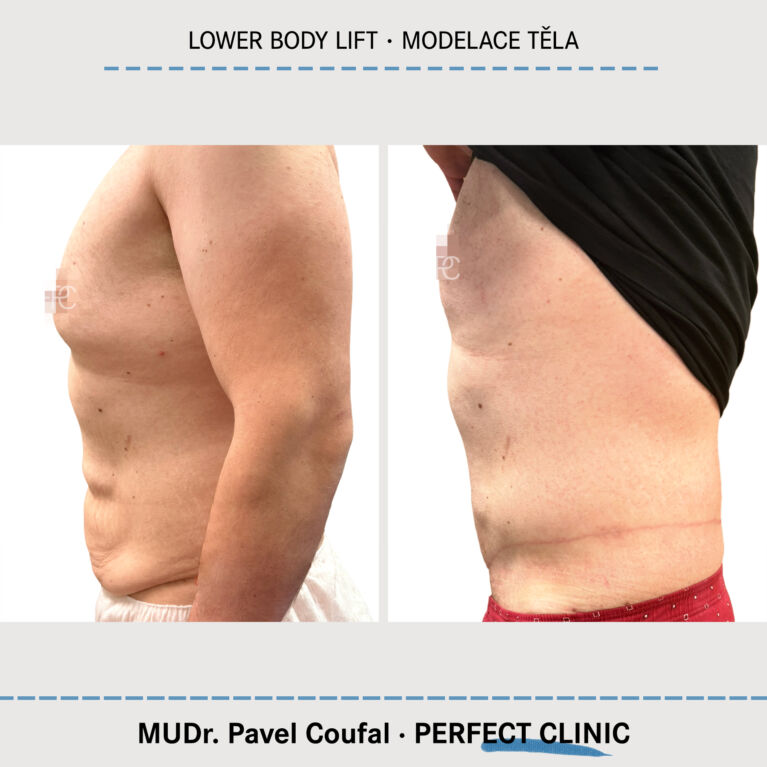 Body Sculpturing