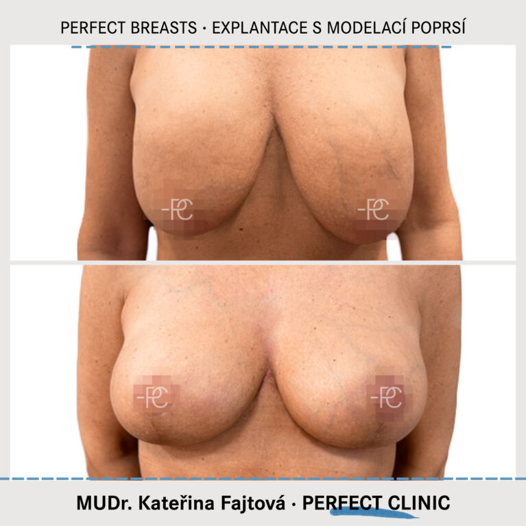 Modelace poprsí
