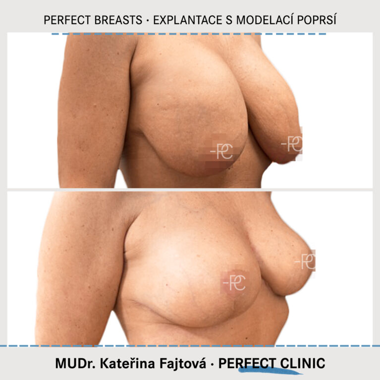 Modelace poprsí