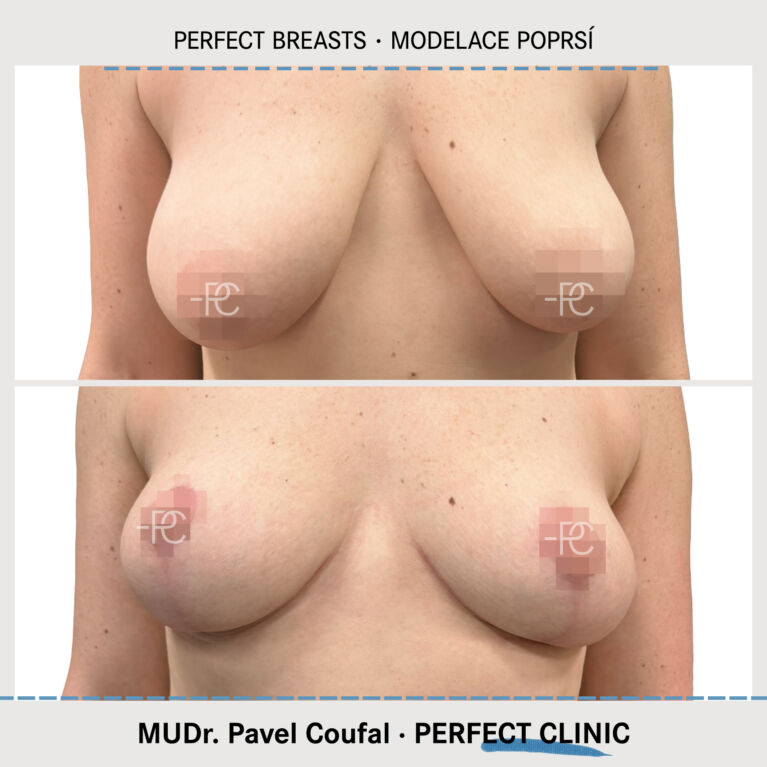 Modelace poprsí