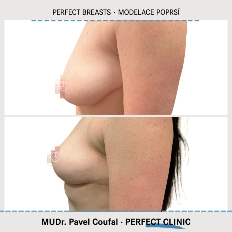 Modelace poprsí