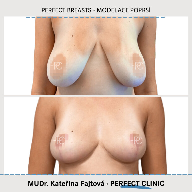 Modelace poprsí