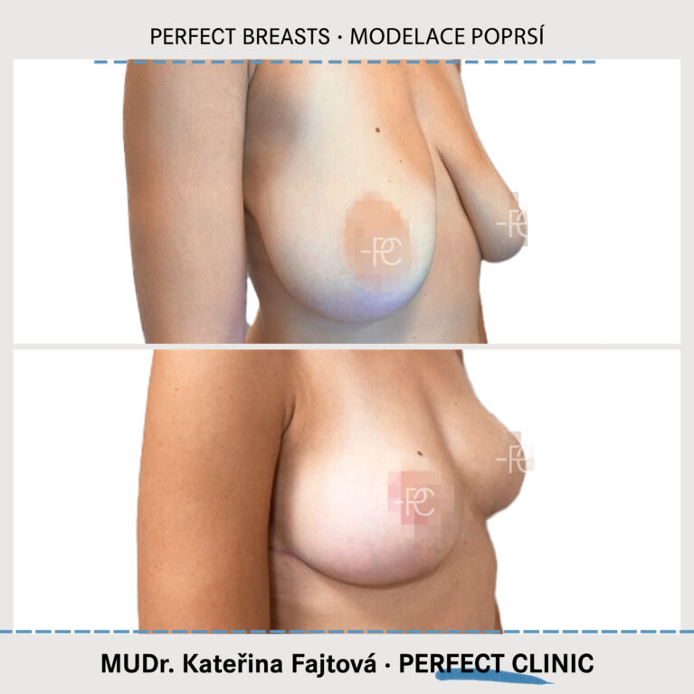 Modelace poprsí