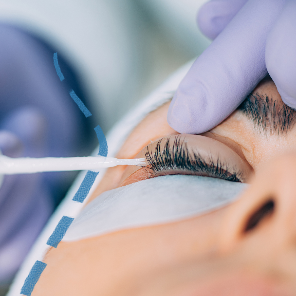 Laminace řas (Lash Lifting) Přirozeně zvýrazněné a opticky delší řasy Chcete mít krásně natočené a nabarvené řasy? Svěřte se do péče odborníků Perfect Clinic · Dermatology.