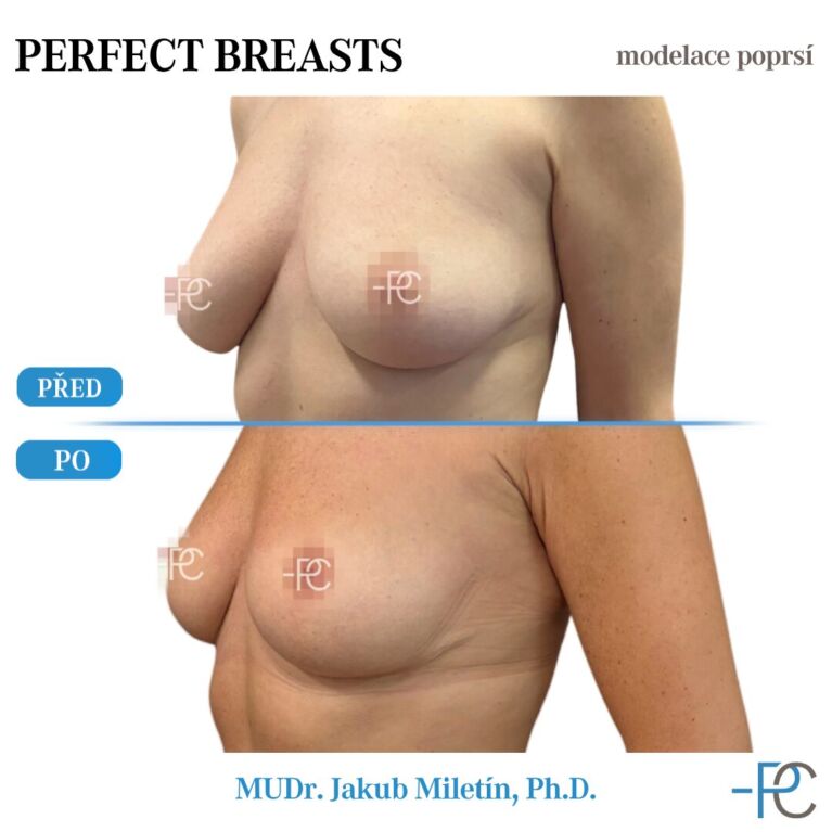 Modelace poprsí