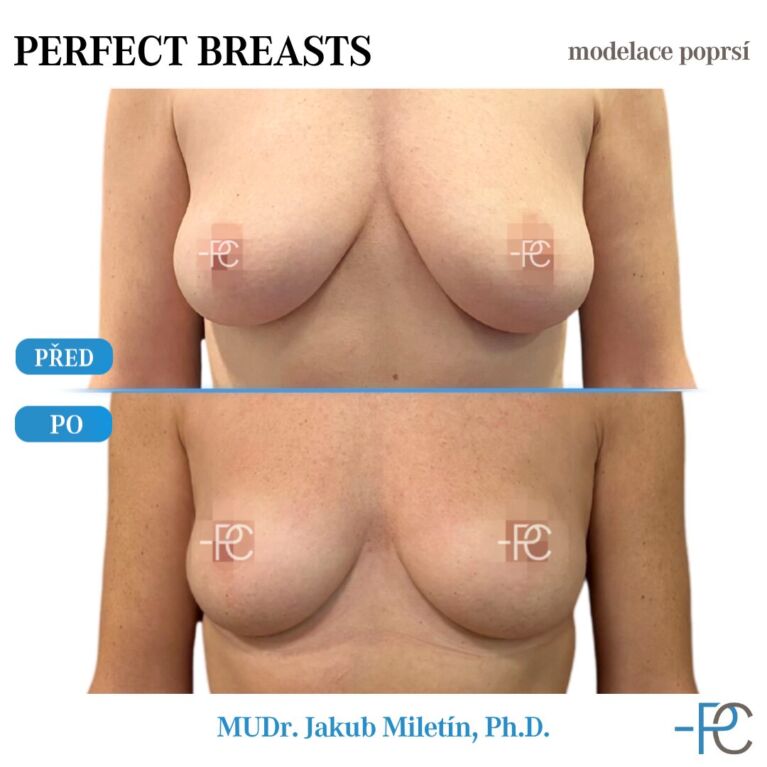 Modelace poprsí