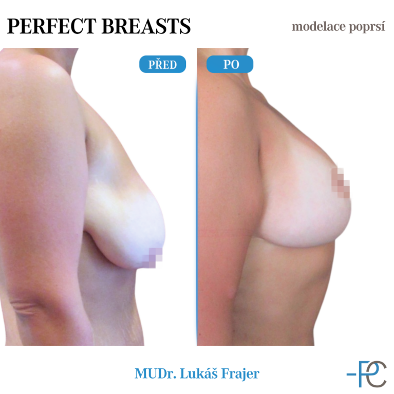 Modelace poprsí