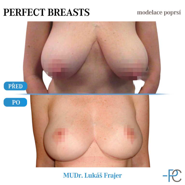 Modelace poprsí