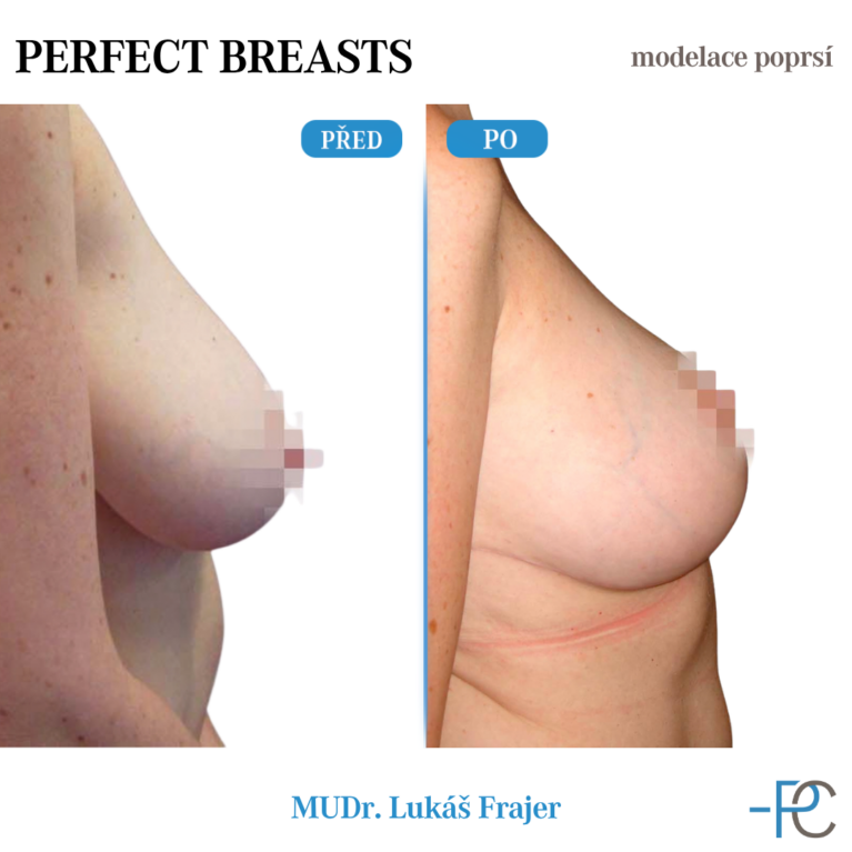 Modelace poprsí