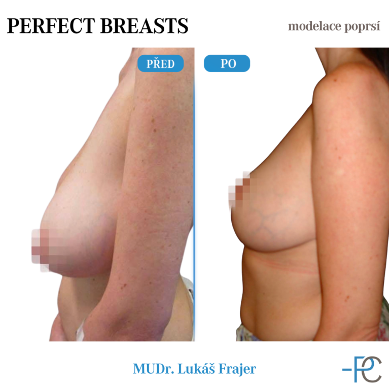 Modelace poprsí